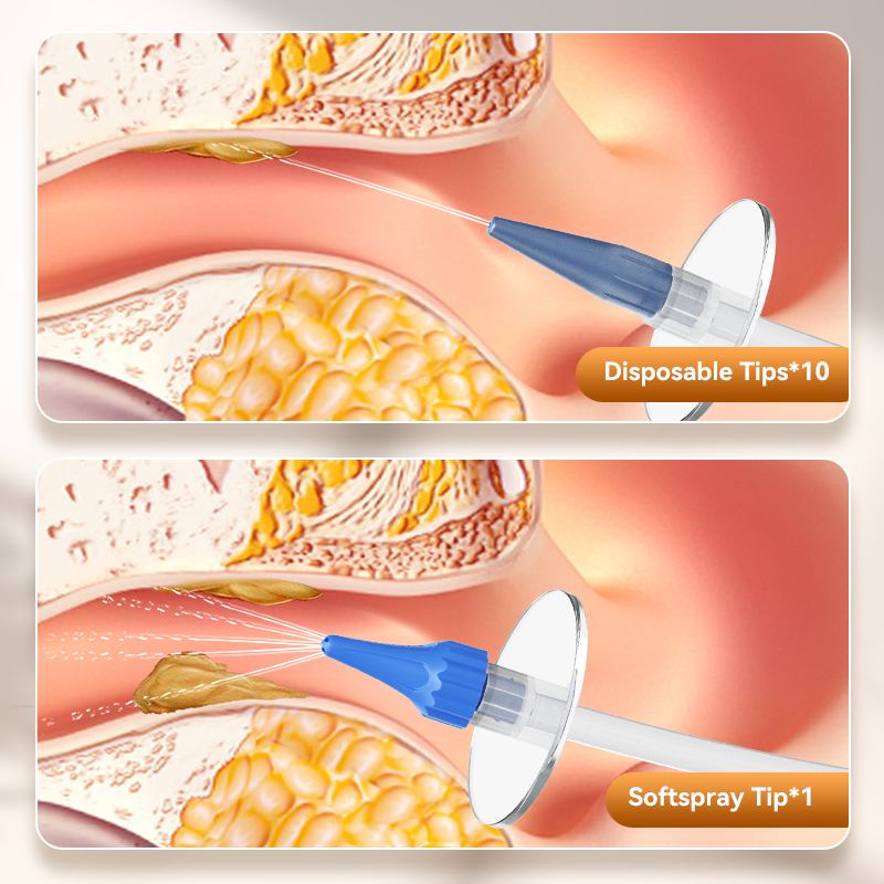 Ear Wax Removal Manual Ear Irr - Smart Garden Watering System recensione e prezzo